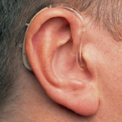 hearing aid behind-the-ear (BTE)